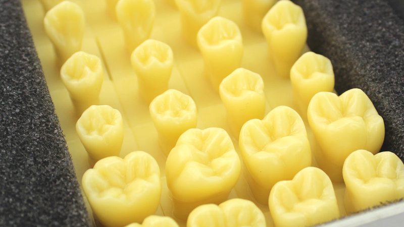 洗牙去牙结石，你真的做对了吗？**
