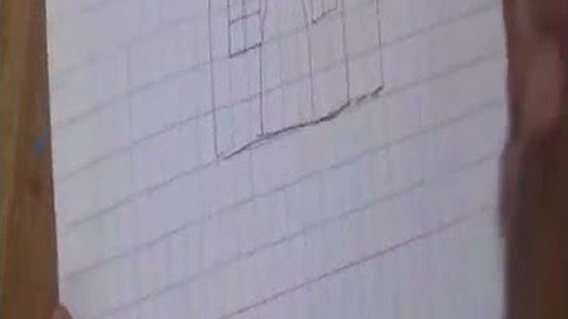 北京正畸前后对比，揭秘牙齿矫正的神奇变化